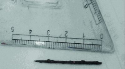 取出的繡花針已發(fā)黑生銹。