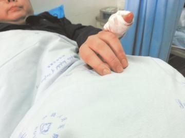 實(shí)習(xí)醫(yī)生陳洪左手的小拇指肌腱斷裂。