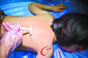 9歲女童得怪病 因服用廉價(jià)激素藥物致全身長毛 9歲女童得怪病 因服用廉價(jià)激素藥物致全身長毛