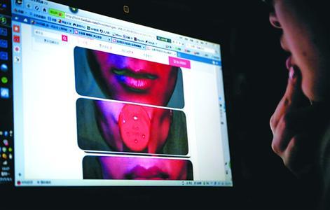 女大學(xué)生用豐唇器致軟組織壞死 嘴唇凸成香腸嘴 女大學(xué)生用豐唇器致軟組織壞死 嘴唇凸成香腸嘴