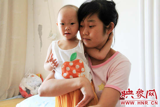 孩子和媽媽在一起，她的右眼已經(jīng)失明。