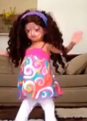 女童患罕見早衰癥 女童患罕見早衰癥