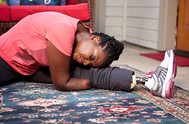 愛美媽媽整形導(dǎo)致截肢 愛美媽媽整形導(dǎo)致截肢