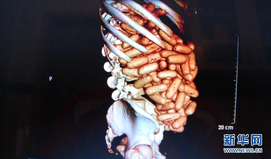 毒品--“潘多拉的盒子” 毒品--“潘多拉的盒子”