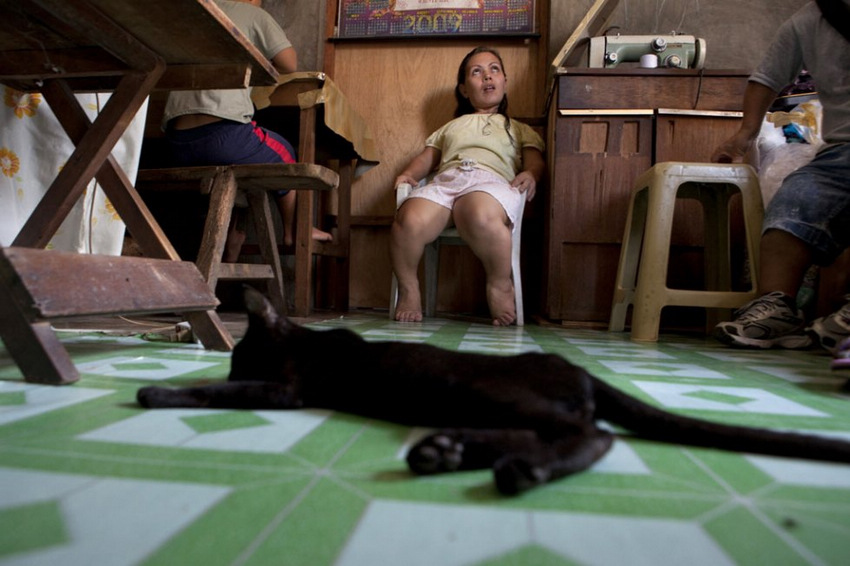 侏儒癥患者的艱辛生活 侏儒癥患者的艱辛生活