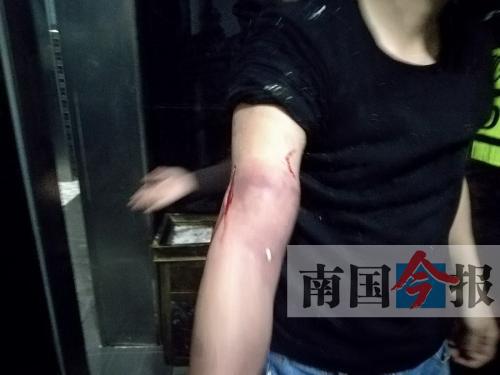 覃先生手臂被卡的部位受傷流血，所幸傷勢(shì)無大礙。 通訊員 王建民 攝