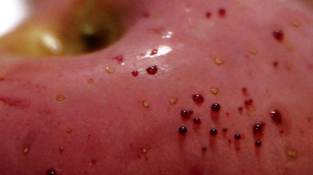 嚇懵！女子用熱水泡蘋果結(jié)果冒出血珠 咋回事？