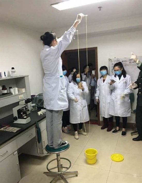 愛吃生肉惹的禍！男子體內(nèi)取出5米長(zhǎng)寄生蟲(圖)