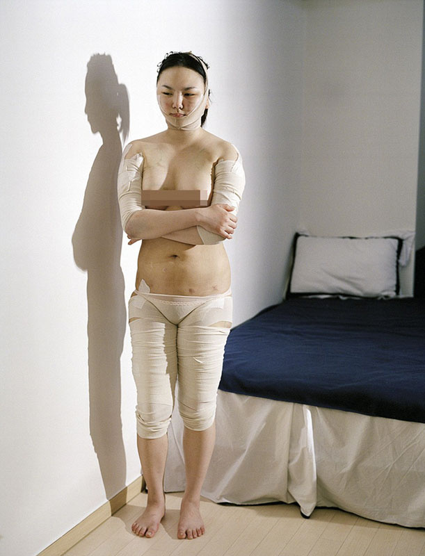 韓攝影師鏡頭記錄患者整容術后的生活 韓攝影師鏡頭記錄患者整容術后的生活