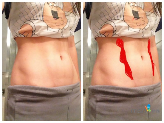 蔡依林 你的馬甲線(xiàn)“脫妝”了！