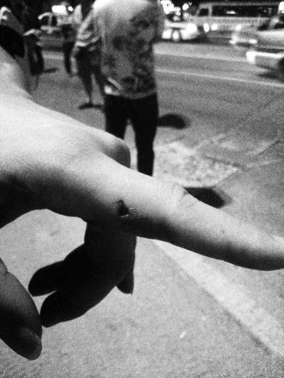 民警食指被咬傷。