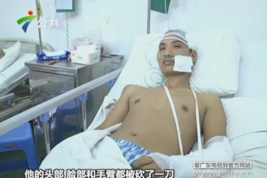 另一名傷者頭部、臉部和手臂都被砍了一刀。(視頻截圖)