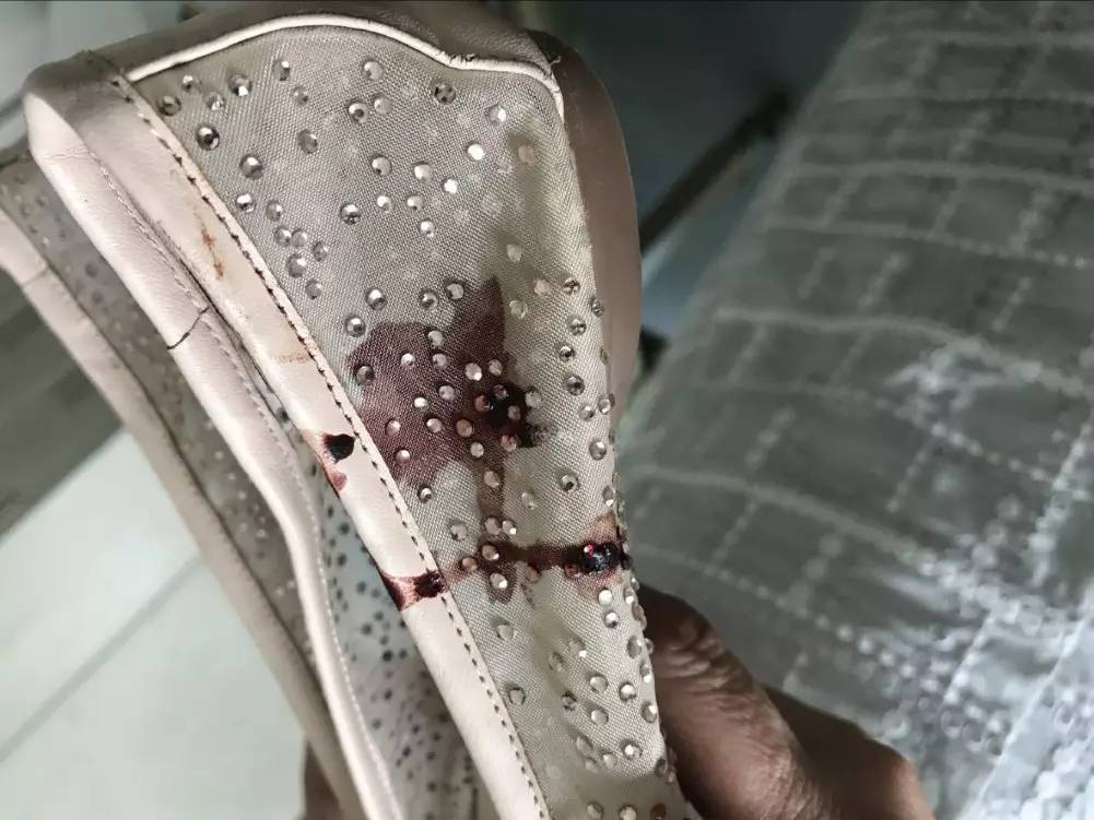 單親媽媽被兩陌生男子打得渾身是血 6歲兒子被嚇哭 單親媽媽被兩陌生男子打得渾身是血 6歲兒子被嚇哭