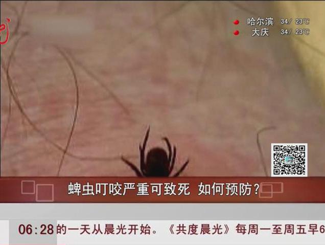 蜱蟲叮咬嚴重可致死如何預防？